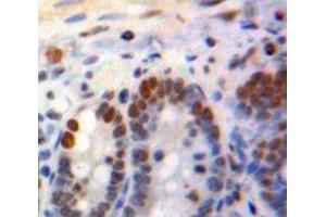 #VALUE! (KLF4 antibody  (AA 240-478))