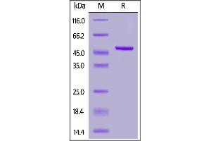 Biotinylated Recombinant Protein L, His,Avitag™ on  under reducing (R) condition. (Protein L Protein (AA 106-470) (His tag,AVI tag,Biotin))
