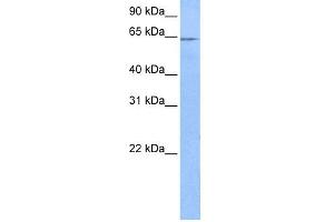 WB Suggested Anti-FAM71A Antibody Titration: 0. (FAM71A antibody  (C-Term))