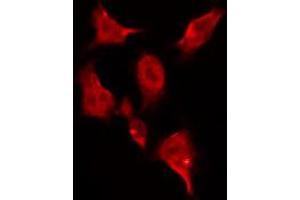 ABIN6269045 staining HeLa by IF/ICC. (CHEK1 antibody  (Internal Region))