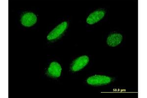 Immunofluorescence of monoclonal antibody to RPAP3 on HeLa cell. (RPAP3 antibody  (AA 1-631))