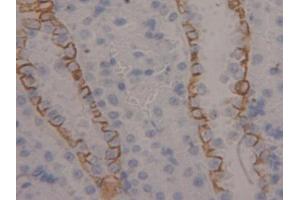 Immunohistochemistry (IHC) image for anti-Keratin 4 (KRT4) (AA 317-454) antibody (ABIN1172975)
