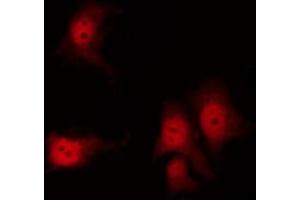 ABIN6267311 staining 293 by IF/ICC. (KRT8 antibody  (pSer432))