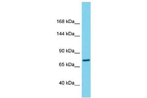 Western Blotting (WB) image for anti-Chromosome 1 Open Reading Frame 112 (C1ORF112) (C-Term) antibody (ABIN2791131) (C1orf112 antibody  (C-Term))