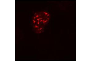 Fig. (DDDDK Tag antibody)
