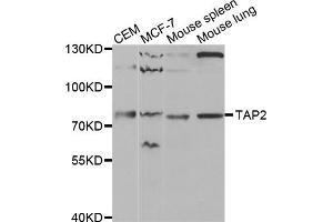 Western blot analysis of extracts of various cell lines, using TAP2 antibody (ABIN5970782) at 1/1000 dilution. (TAP2 antibody)
