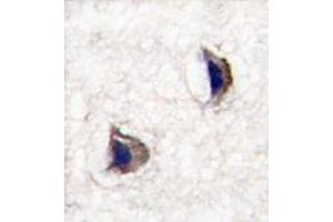 Formalin-fixed and paraffin-embedded human brain tissue reacted with NP1 (Nptx1) Antibody (Center) , which was peroxidase-conjugated to the secondary antibody, followed by DAB staining. (NPX1 antibody  (Middle Region))