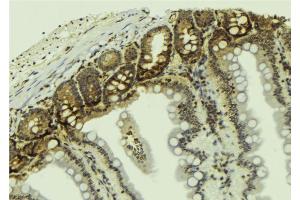 Immunohistochemistry (IHC) image for anti-Mdm2, p53 E3 Ubiquitin Protein Ligase Homolog (Mouse) (MDM2) (pSer166) antibody (ABIN6256167)