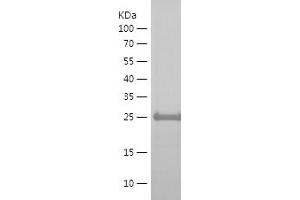 Western Blotting (WB) image for Mannosidase, beta A, Lysosomal-Like (MANBAL) (AA 45-85) protein (His-IF2DI Tag) (ABIN7282671) (MANBAL Protein (AA 45-85) (His-IF2DI Tag))