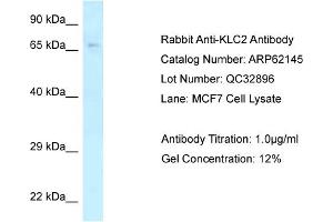 Western Blotting (WB) image for anti-Kinesin Light Chain 2 (KLC2) (C-Term) antibody (ABIN2789036) (KLC2 antibody  (C-Term))