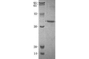 Western Blotting (WB) image for Prostate Specific Antigen (PSA) (Transcript Variant 3) protein (His tag) (ABIN2723968)