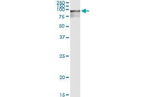 Immunoprecipitation (IP) image for anti-RNA Binding Motif Protein 5 (RBM5) (AA 1-546) antibody (ABIN950062)