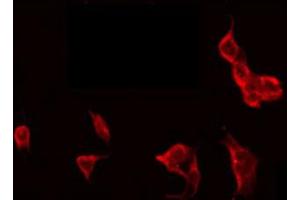 ABIN6272285 staining HT29 by IF/ICC. (DCL1 antibody  (Internal Region))