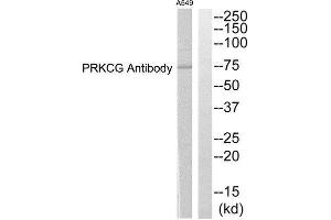 Western Blotting (WB) image for anti-Protein Kinase C, gamma (PRKCG) (Internal Region) antibody (ABIN1852723) (PKC gamma antibody  (Internal Region))
