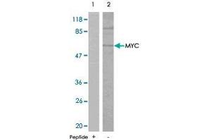 Western blot analysis of extracts from ovary cancer cells , using MYC polyclonal antibody  . (c-MYC antibody)