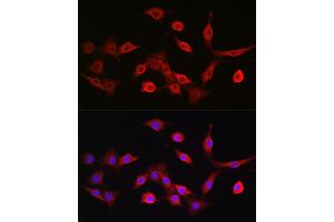 Immunofluorescence analysis of NIH/3T3 cells using T Rabbit pAb (ABIN3022236, ABIN3022237, ABIN3022238, ABIN1513586 and ABIN6218687) at dilution of 1:100 (40x lens).