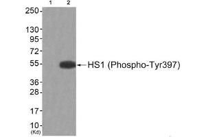 Western blot analysis of extracts from JK cells (Lane 2), using HS1 (Phospho-Tyr397) Antibody. (HCLS1 antibody  (pTyr397))