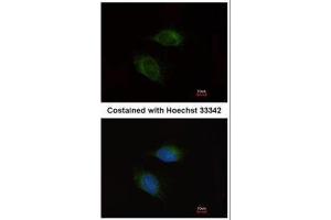 ICC/IF Image Immunofluorescence analysis of methanol-fixed HeLa, using MMP9, antibody at 1:200 dilution. (MMP 9 antibody)