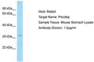 Image no. 1 for anti-Protein Kinase C, delta Binding Protein (PRKCDBP) (AA 77-126) antibody (ABIN6749921) (PRKCDBP antibody  (AA 77-126))