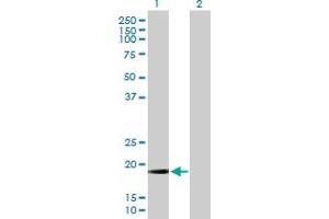 Western Blot analysis of MRPL13 expression in transfected 293T cell line by MRPL13 MaxPab polyclonal antibody. (MRPL13 antibody  (AA 1-178))