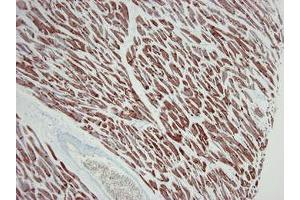 Image no. 3 for anti-Actin, Alpha, Cardiac Muscle 1 (ACTC1) antibody (ABIN959519) (ACTC1 antibody)
