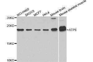 Western blot analysis of extracts of various cell lines, using ATP6 antibody (ABIN5975827) at 1/1000 dilution. (MT-ATP6 antibody)