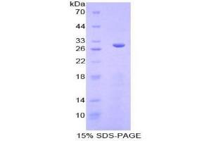 SDS-PAGE analysis of Mouse SGK3 Protein.