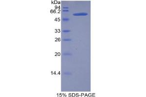 SDS-PAGE analysis of Mouse Lipase, Hepatic Protein. (LIPC Protein)