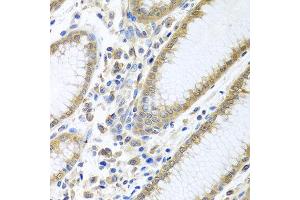 Immunohistochemistry of paraffin-embedded human stomach using EIF4E antibody at dilution of 1:100 (40x lens). (EIF4E antibody)