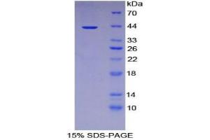 SDS-PAGE analysis of Human IL12Rb2 Protein.