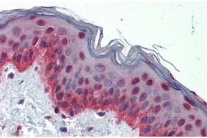 Human Skin (formalin-fixed, paraffin-embedded) stained with NFIX antibody ABIN462183 followed by biotinylated goat anti-rabbit IgG secondary antibody ABIN481713, alkaline phosphatase-streptavidin and chromogen. (NFIX antibody  (AA 181-230))