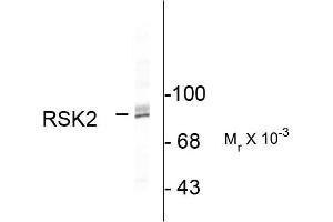 Western blots of HeLa lysate showing specific immunolabeling of the ~90k RSK2 protein.