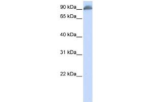 WB Suggested Anti-EPB41 Antibody Titration:  0. (EPB41 antibody  (N-Term))