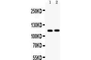 Anti- ATP2A2 antibody, Western blotting All lanes: Anti ATP2A2  at 0. (ATP2A2 antibody  (N-Term))