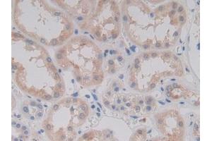 Detection of PCPE2 in Human Kidney Tissue using Polyclonal Antibody to Procollagen C Proteinase Enhancer 2 (PCPE2)