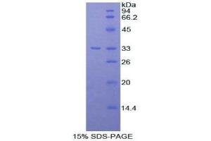 SDS-PAGE (SDS) image for Serpin Family A Member 7 (SERPINA7) (AA 114-391) protein (His tag) (ABIN2122216)