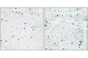 Immunohistochemistry analysis of paraffin-embedded human brain tissue, using TRIM24 Antibody. (TRIM24 antibody  (AA 1001-1050))