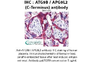 Image no. 1 for anti-Autophagy Related 9B (ATG9B) (C-Term) antibody (ABIN1732024) (ATG9B antibody  (C-Term))