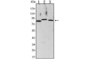 Western Blot showing CHUK antibody used against Raji (1), Jurkat (2) and THP-1 (3) cell lysate. (IKK alpha antibody)