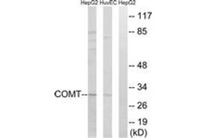 Western blot analysis of extracts from HuvEc/HepG2 cells, using COMT Antibody. (COMT antibody  (AA 61-110))