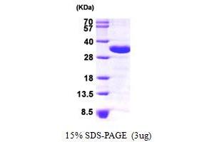 CHMP2A Protein (AA 1-222) (His tag)