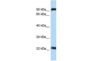 WB Suggested Anti-Uhrf2 Antibody Titration: 1. (UHRF2 antibody  (N-Term))