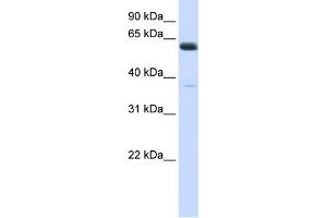 WB Suggested Anti-ALG6 Antibody Titration:  0. (ALG6 antibody  (N-Term))