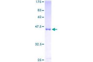Shootin-1 (SHTN1) (AA 1-125) protein (GST tag)