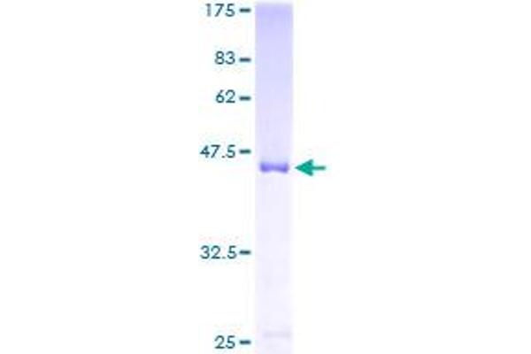 Shootin-1 (SHTN1) (AA 1-125) protein (GST tag)
