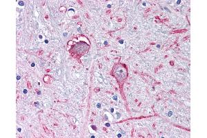 Anti-GABRA3 antibody IHC of human brain, globus pallidus. (GABRA3 antibody  (C-Term))
