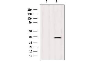 Western blot analysis of extracts from HepG2, using Histone H1.