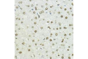Immunohistochemistry of paraffin-embedded rat liver using Phospho-Histone H3-T45 antibody (ABIN7267692) at dilution of 1:100 (40x lens). (Histone 3 antibody  (H3T45p))