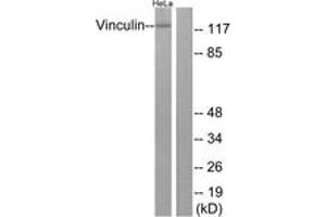 Western blot analysis of extracts from HeLa cells, treated with forskolin 40nM 30', using Vinculin (Ab-821) Antibody. (Vinculin antibody  (AA 786-835))