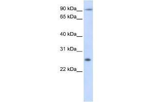 Tetraspanin 31 antibody used at 1 ug/ml to detect target protein. (TSPAN31 antibody  (Middle Region))